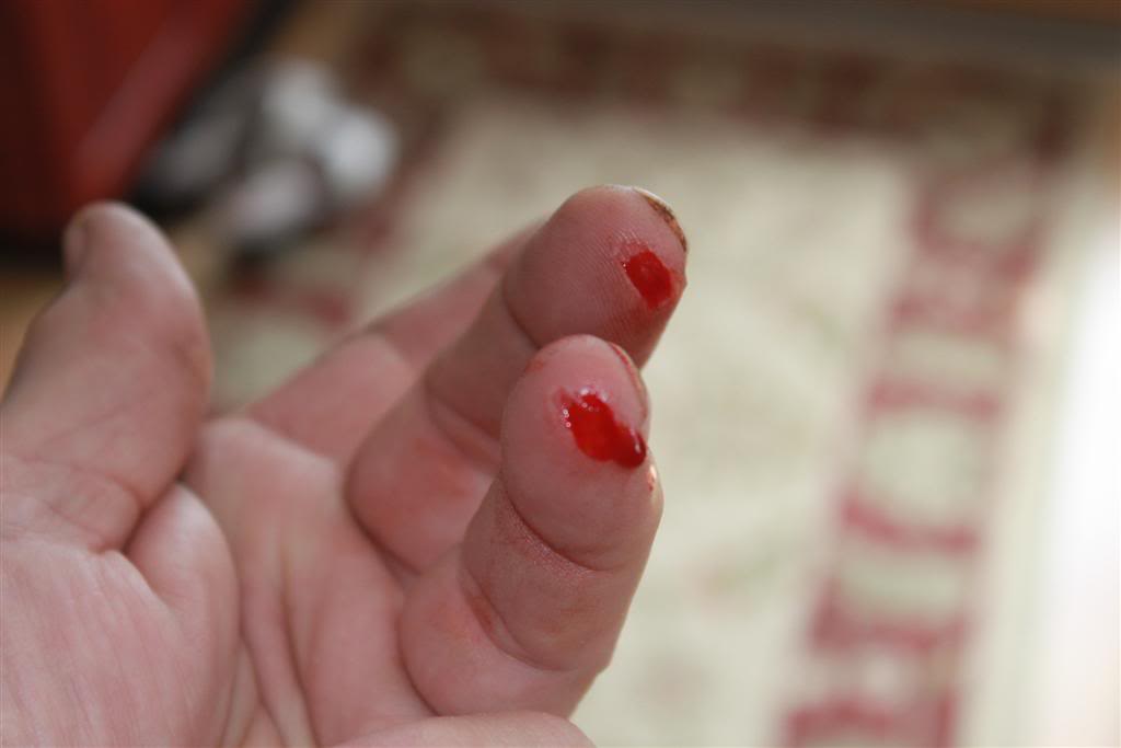 cutfingerLarge.jpg