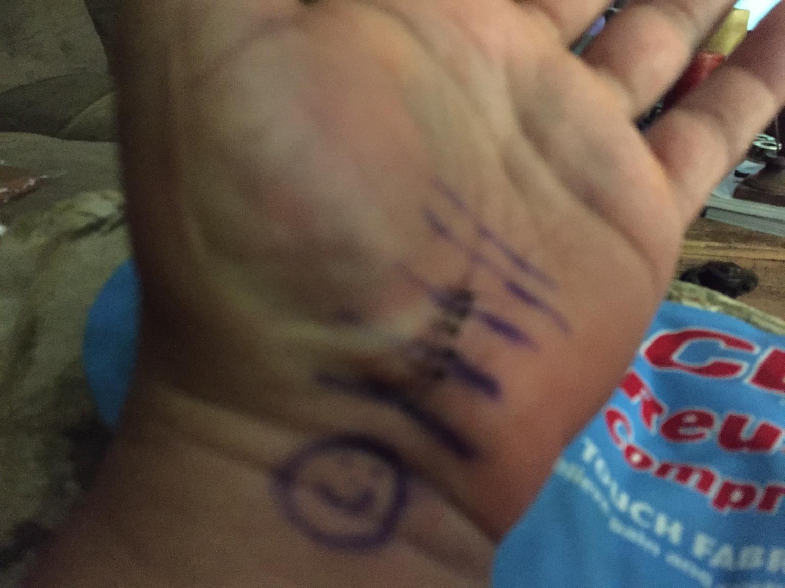 stiches.thumb.jpg.bce027a937e79fbd6a65b5