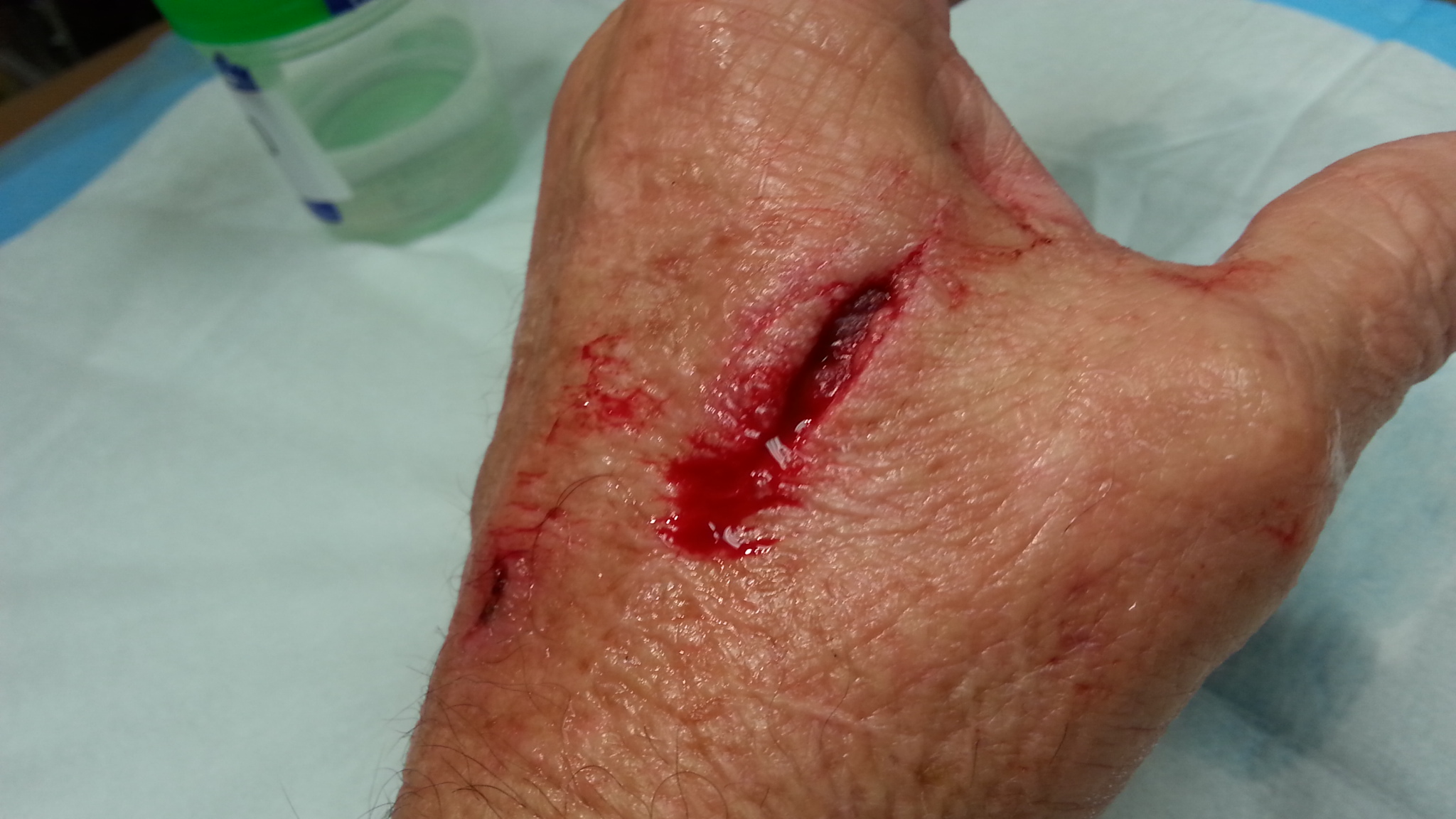 Did you know that Random Orbital Sanders Bite?