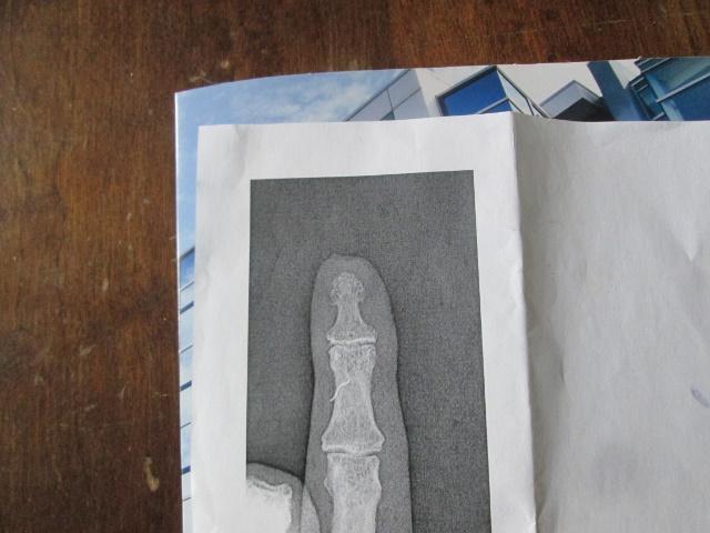 x-ray.jpg.8eea1c6f559d5cc8cb9b4fe75827cda9.jpg