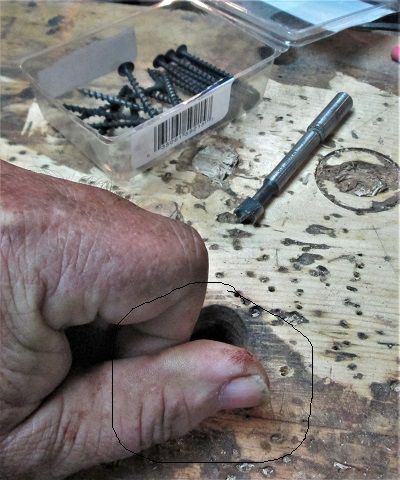 Darn splinter