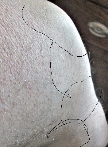 403444917_Badkneelumpy.JPG.94d248c103710b97838a58955a77305d.JPG