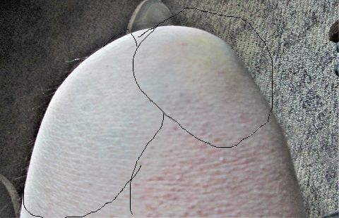 695710341_BadkneeBUMP.JPG.99d80c8e3ec56eb6292c68611c5f7f8a.JPG