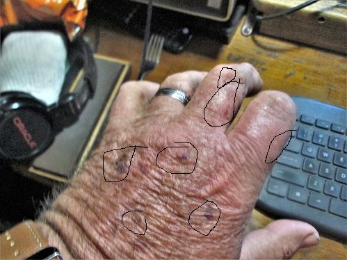 1544311590_FatherMurphyBattlescars.JPG.cce0eeaab9a9ea2185aae021ac3d2d9b.JPG
