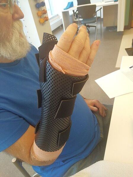 FEB 21, Braced up  .jpg